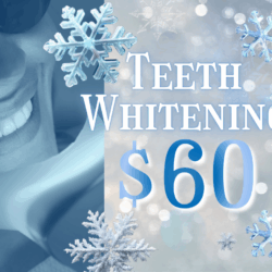 Frozen Sale: Teeth Whitening